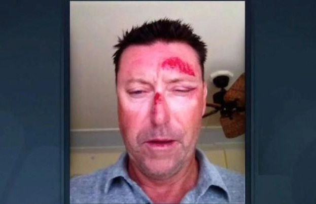 TBT Robert Allenby